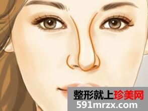 鼻子歪了怎么整？