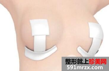巨乳症缩小术需要尽早做吗