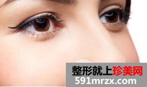 膨体隆鼻取出恢复期是多长?