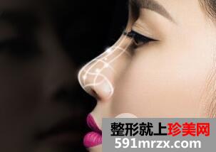 膨体隆鼻可以终身不取出吗?