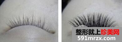 睫毛种植会伤害到眼睛吗？