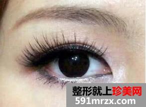睫毛种植后如何护理？
