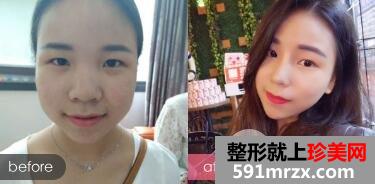 上海yestar艺星整形口碑好吗?医院怎么样？整形价格表