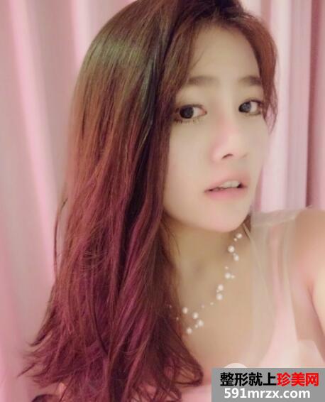 在美联臣整形医院做的女性私密整形阴道紧缩手术价格和案例