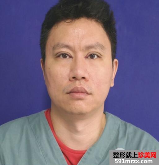 男士切开双眼皮开内眼角一个月恢复自然 价格和图片