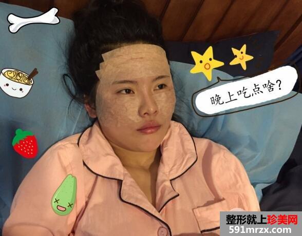 脸部凹陷做脸部脂肪填充好吗？多少钱？真人案例多对比照片