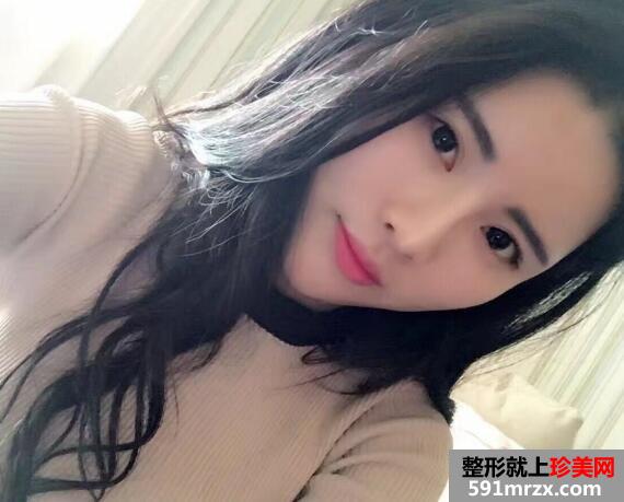脸部凹陷做脸部脂肪填充好吗？多少钱？真人案例多对比照片