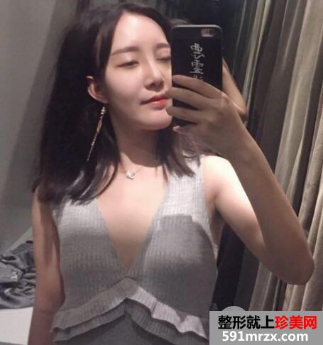 硅胶假体隆鼻和垫下巴价格适宜效果好 真实案例