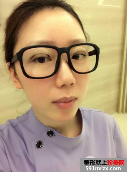 北京八大处整容医院双眼皮手术真实案例和整形价格表