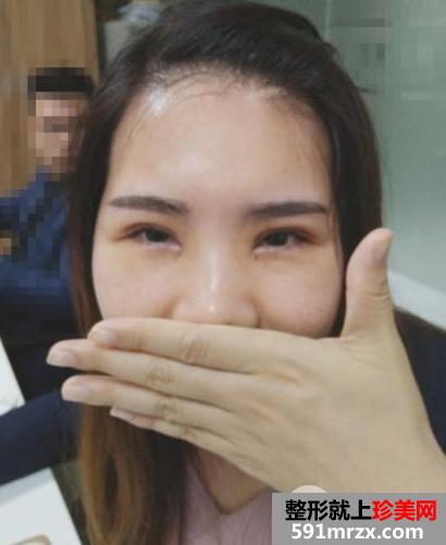 北京丽都美容医院医疗价目表和双眼皮手术案例