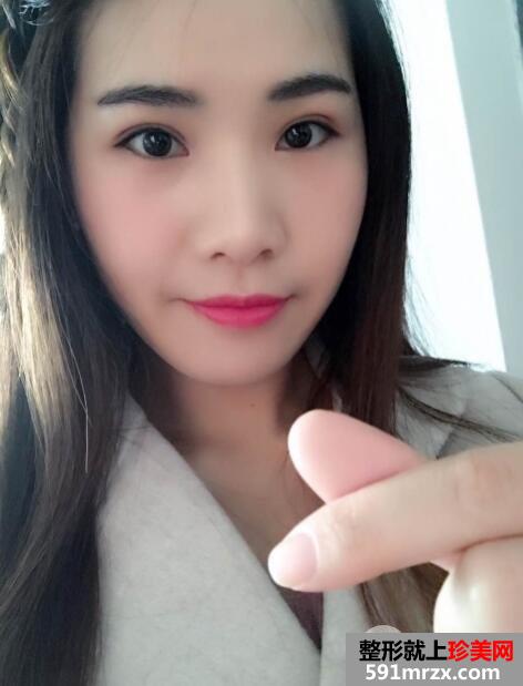 北京丽都美容医院医疗价目表和双眼皮手术案例