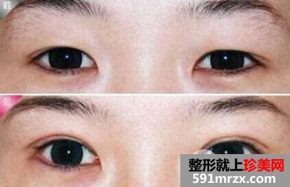 上海比利华医疗美容医院整形价格表一览
