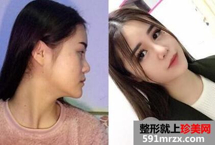 上海比利华医疗美容医院整形价格表一览