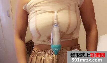 假体隆胸手术价格和案例