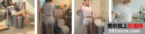 本人自体脂肪丰胸手术3个月前后照片和亲身经历