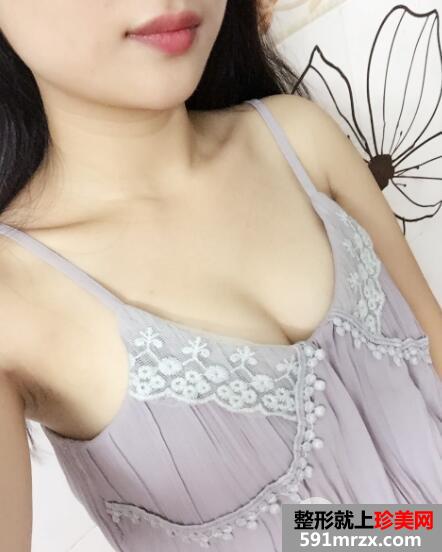 自体脂肪填充丰胸医院北京禾美嘉案例