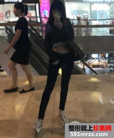 北京东方和谐整形冯斌自体脂肪面部填充价格案例