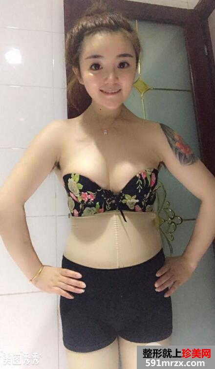 北京自体脂肪移植专家冯斌自体隆胸+全脸脂肪填充价格案例