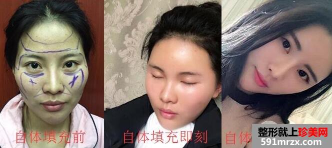 上海美联臣医院地址和美联臣整形价格表