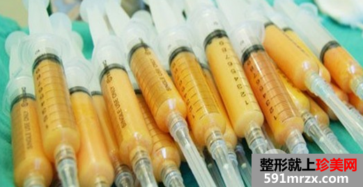 玻尿酸和自体脂肪填充面部凹陷哪个好?优劣势全面对比分析