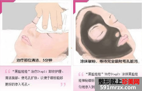 黑脸娃娃有用吗？效果整么样？整形医院推荐