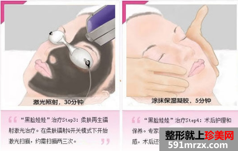 黑脸娃娃有用吗？效果整么样？整形医院推荐