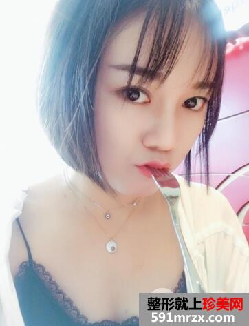果酸换肤的效果8