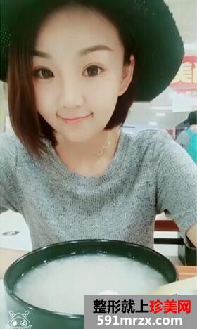 三点式双眼皮9