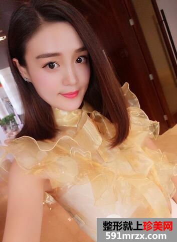 玻尿酸丰苹果肌9