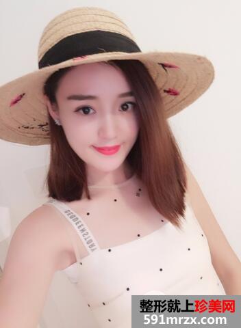 玻尿酸丰苹果肌12
