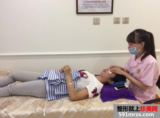 激光去眼袋3