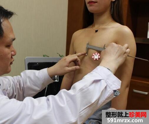 自体脂肪隆胸4
