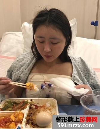 假体隆胸7