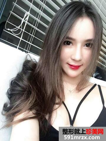 假体隆胸11