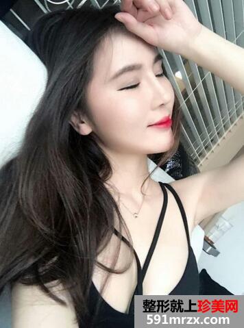 假体隆胸12