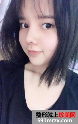 鼻头肥大矫正7