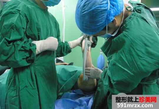 注射溶脂减肥4