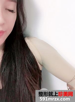 注射溶脂减肥9