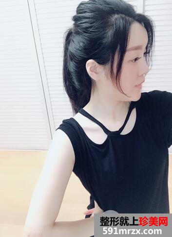 注射溶脂减肥11