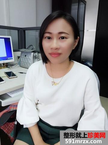 如何减少眼角皱纹3