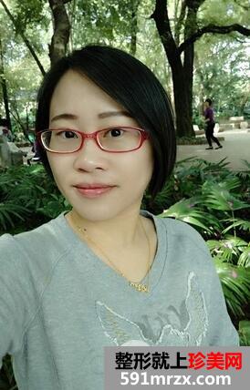 如何减少眼角皱纹5
