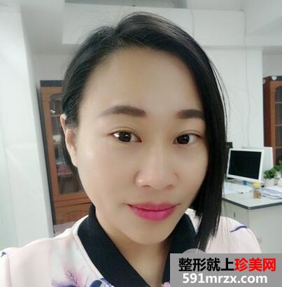 如何减少眼角皱纹7