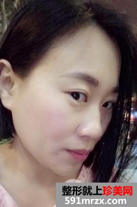 如何减少眼角皱纹8