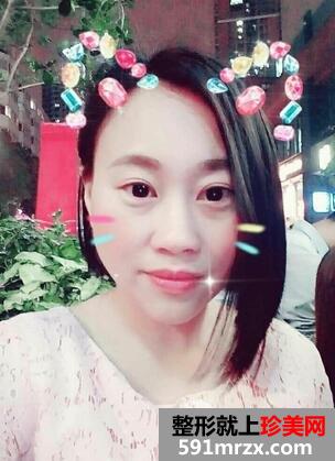 如何减少眼角皱纹10