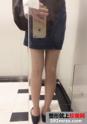 保妥适瘦小腿6