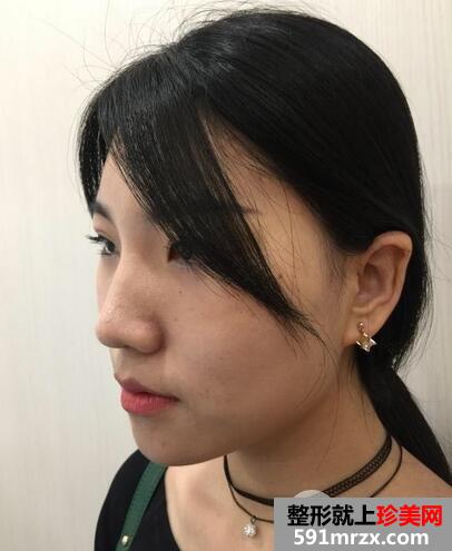 全身美白有效方法1