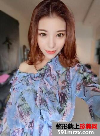 怎樣去鼻唇溝6