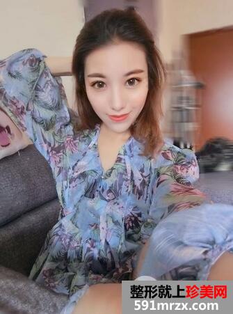怎樣去鼻唇溝7