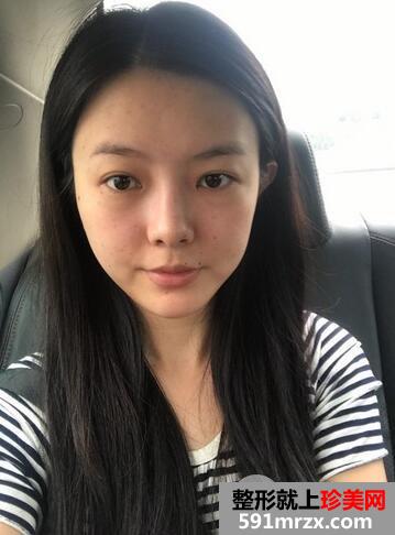 鼻综合2