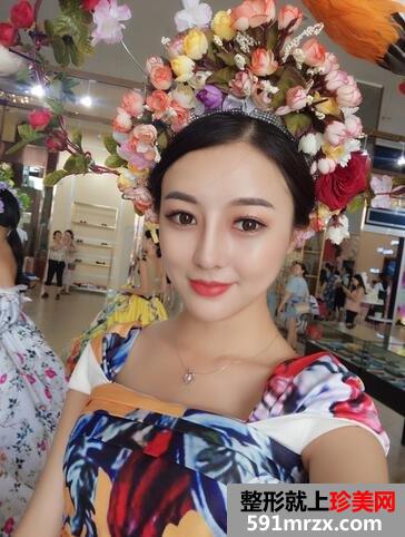 鼻综合69